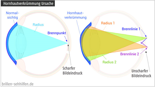 auge.png