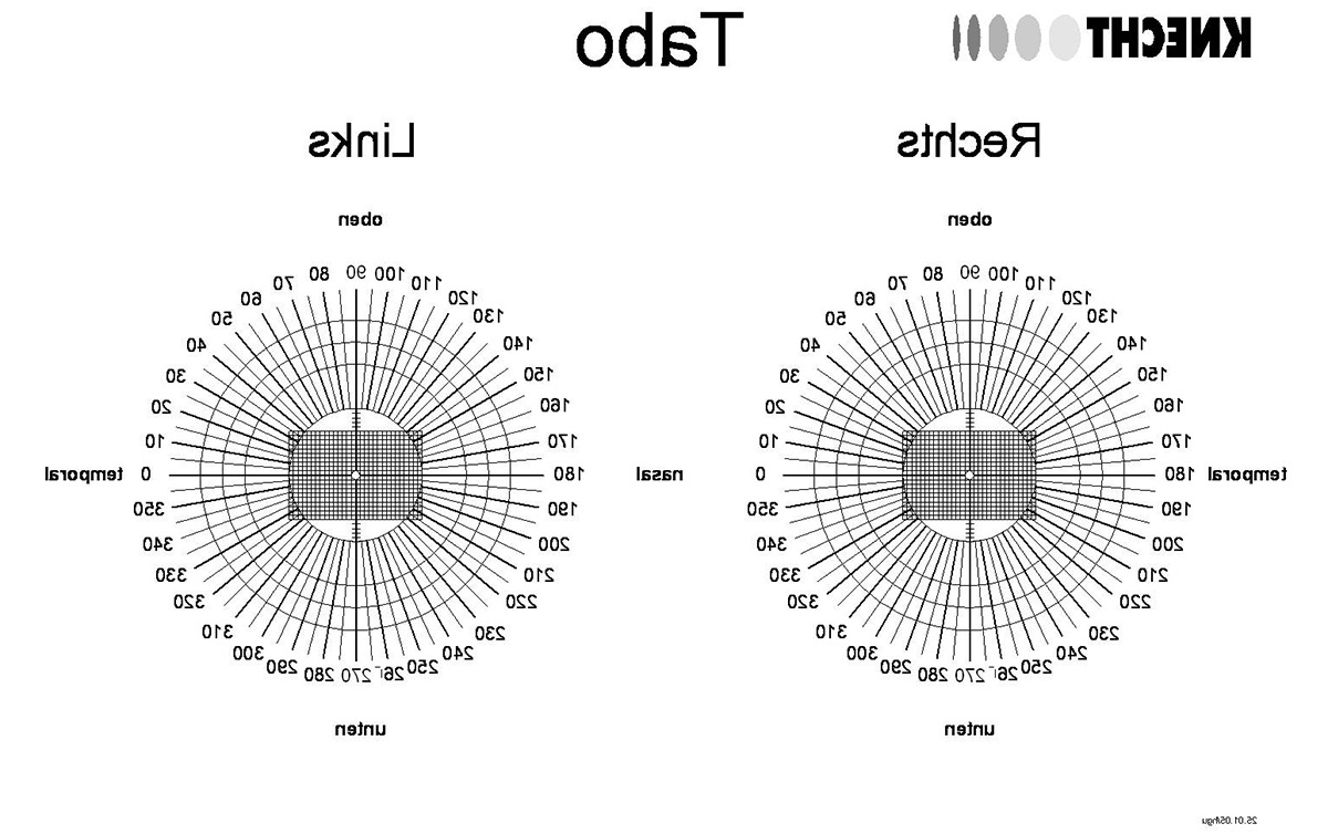 Tabo-aus-dem-Auge-Minuszylinder.jpg