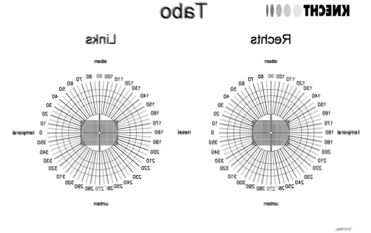 Tabo-aus-dem-Auge-Minuszylinder-ohne-Brille.jpg