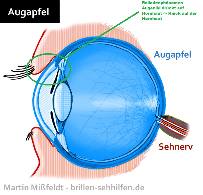 augapfel.jpg