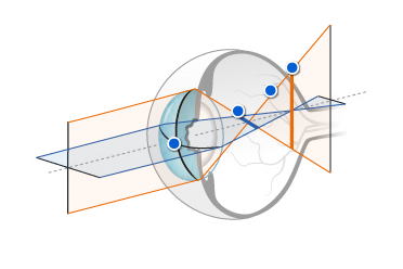 Zeiss Konoid.PNG